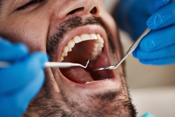 Fast & Reliable Emergency Dental Services in FL